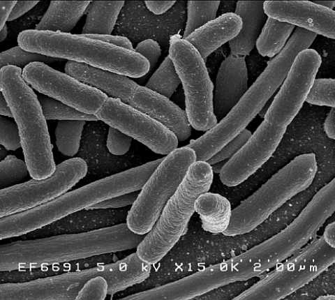 Scanning electron micrograph of Escherichia coli, grown in culture and adhered to a cover slip. (Photo: NIH/NIAID)
