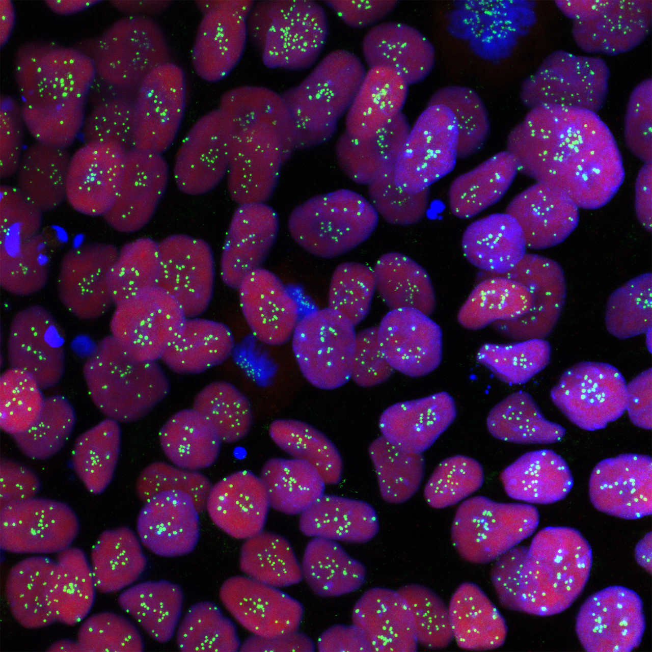 Haploid human embryonic stem cells (Credit: Azrieli Center for Stem Cells and Genetic Research at Hebrew University)
